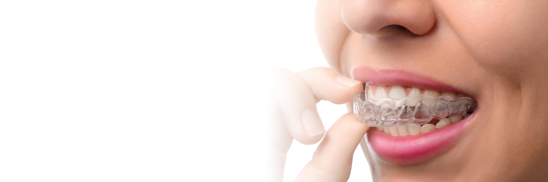 close up of woman holding invisalign in melbourne fl